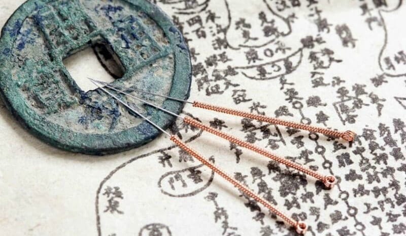 acupuncture needles